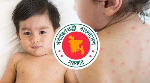 হাম উপসর্গে আরও ৪ শিশুর মৃত্যু