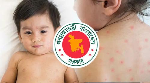 হামের উপসর্গে আরও ৬ শিশুর মৃত্যু
