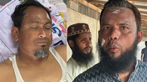 কুড়িগ্রামে মৌমাছির কামড়ে জামায়াতের ৩ নেতাকর্মী আহত